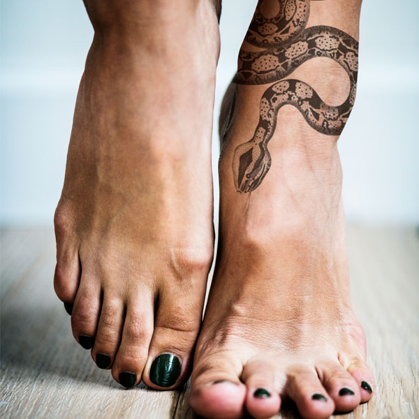 eliminare tattoo bari